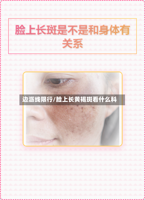 边沥线限行/脸上长黄褐斑看什么科